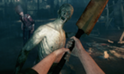 ZombiU 06 06 2012 head 3